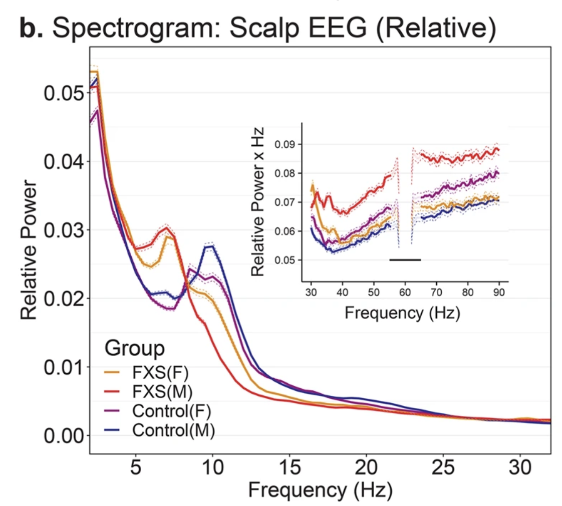 EEG Spectrogram comparing brain activity patterns